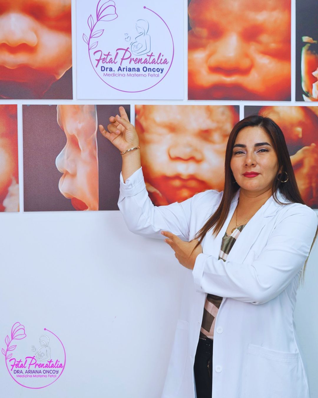 ESPECIALIDAD EN ECOGRAFIA FETAL PRENATALIA