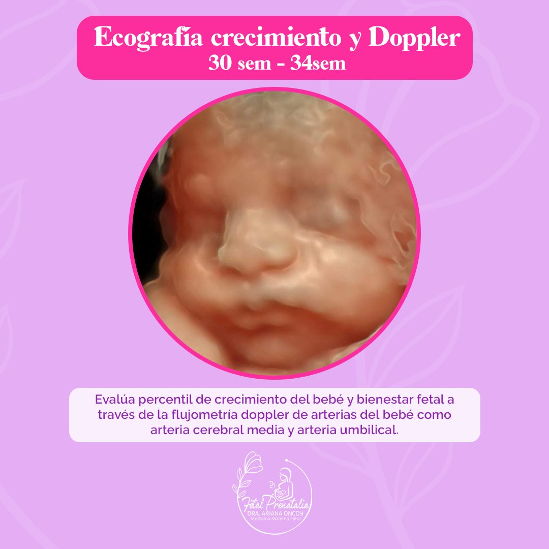 ecografia fetal prenatalia