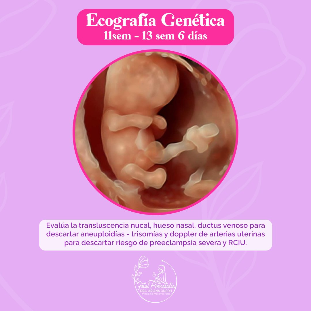 ecografia fetal prenatalia