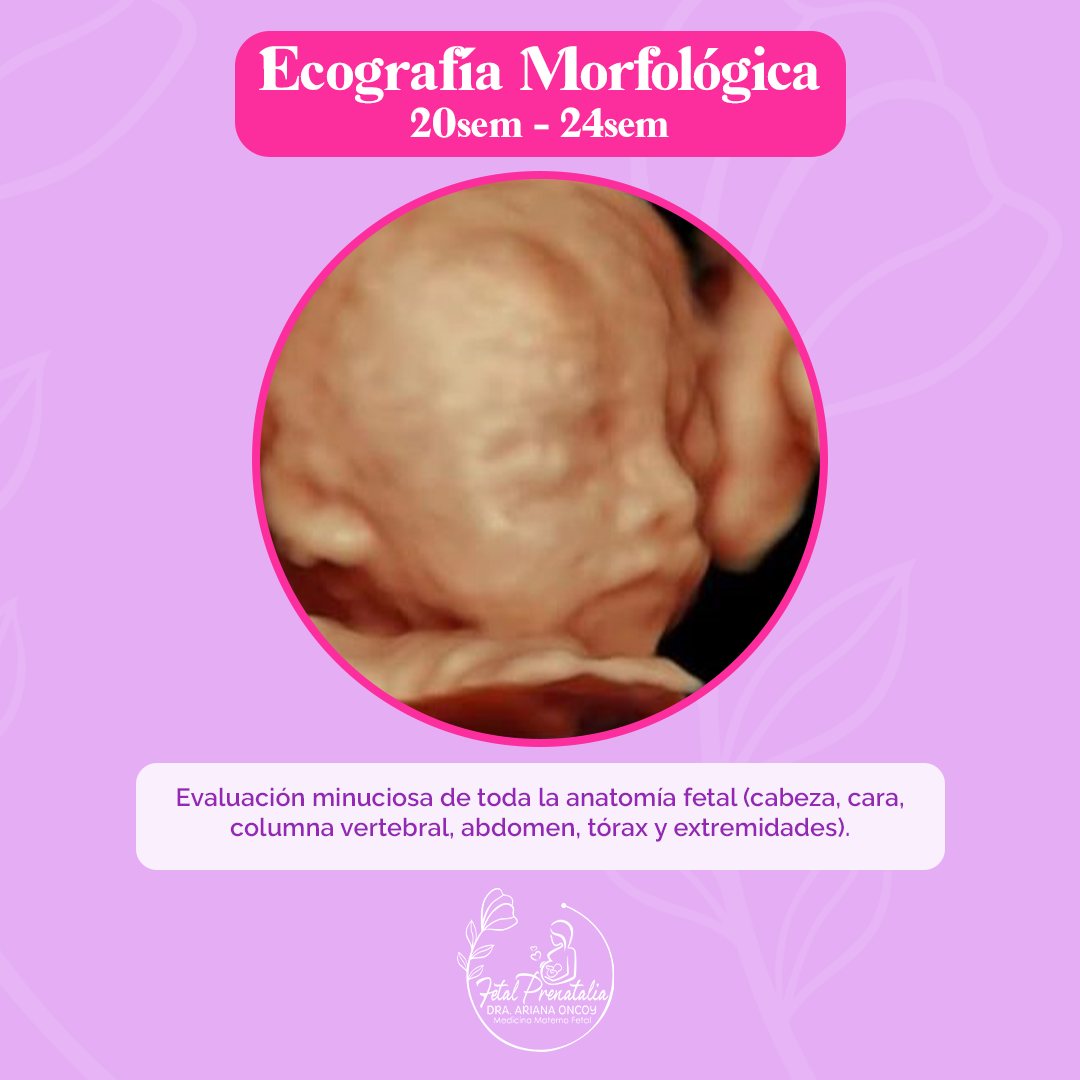 ecografia fetal prenatalia